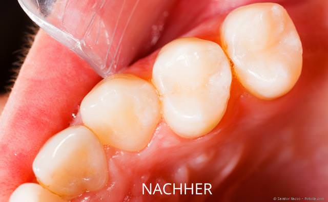 310_kons_komposit_nachher2_fotolia_Sandor_Kacso_640x395-1920w