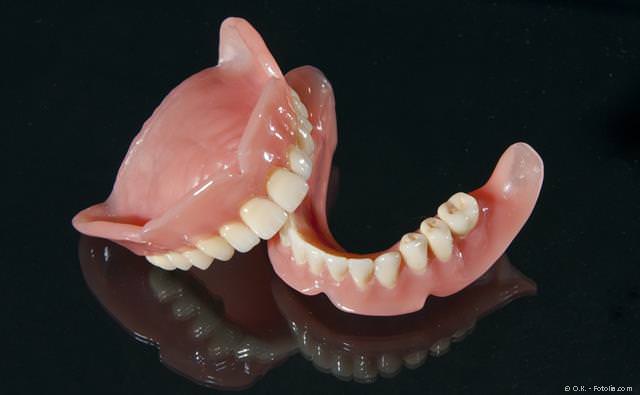 In vielen Fällen können an Stelle von Totalprothesen feste Zähne mit Implantaten gemacht werden.