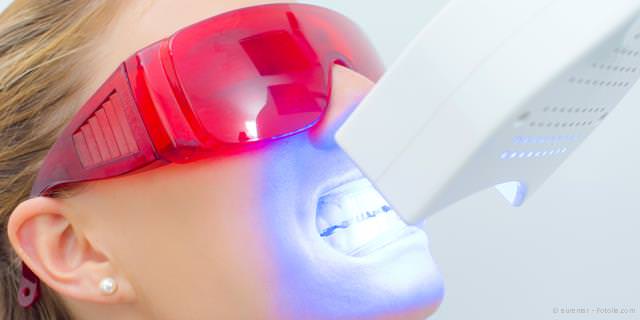 Schnellere Zahnaufhellung mit Licht-Aktivierung