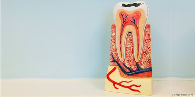 Wurzelbehandlung - Eigene Zähne erhalten und Geld sparen