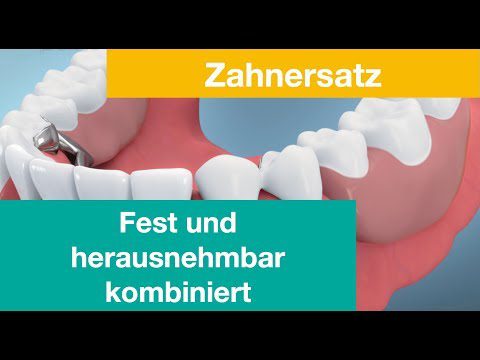 Video Vorschaubild